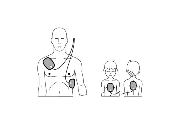 défibrillateur-aed-électrode-position